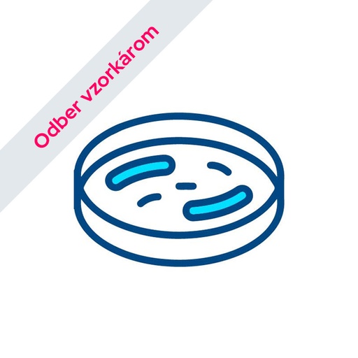 [RVM] Mikrobiologický rozbor vody